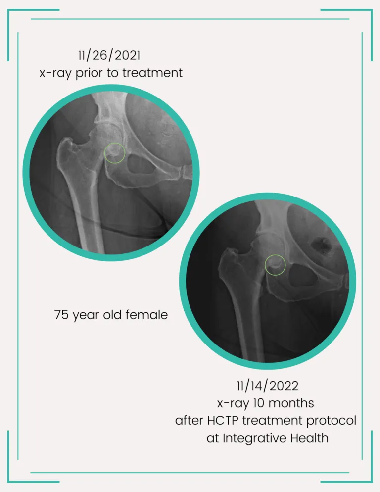 before and after xrays